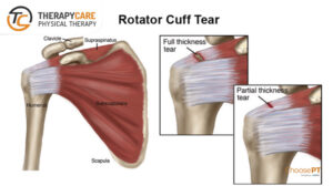 TherapyCare - Physical Therapy