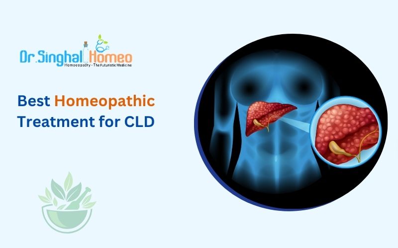 Exploring Homeopathic Treatment for Chronic Liver Disease
