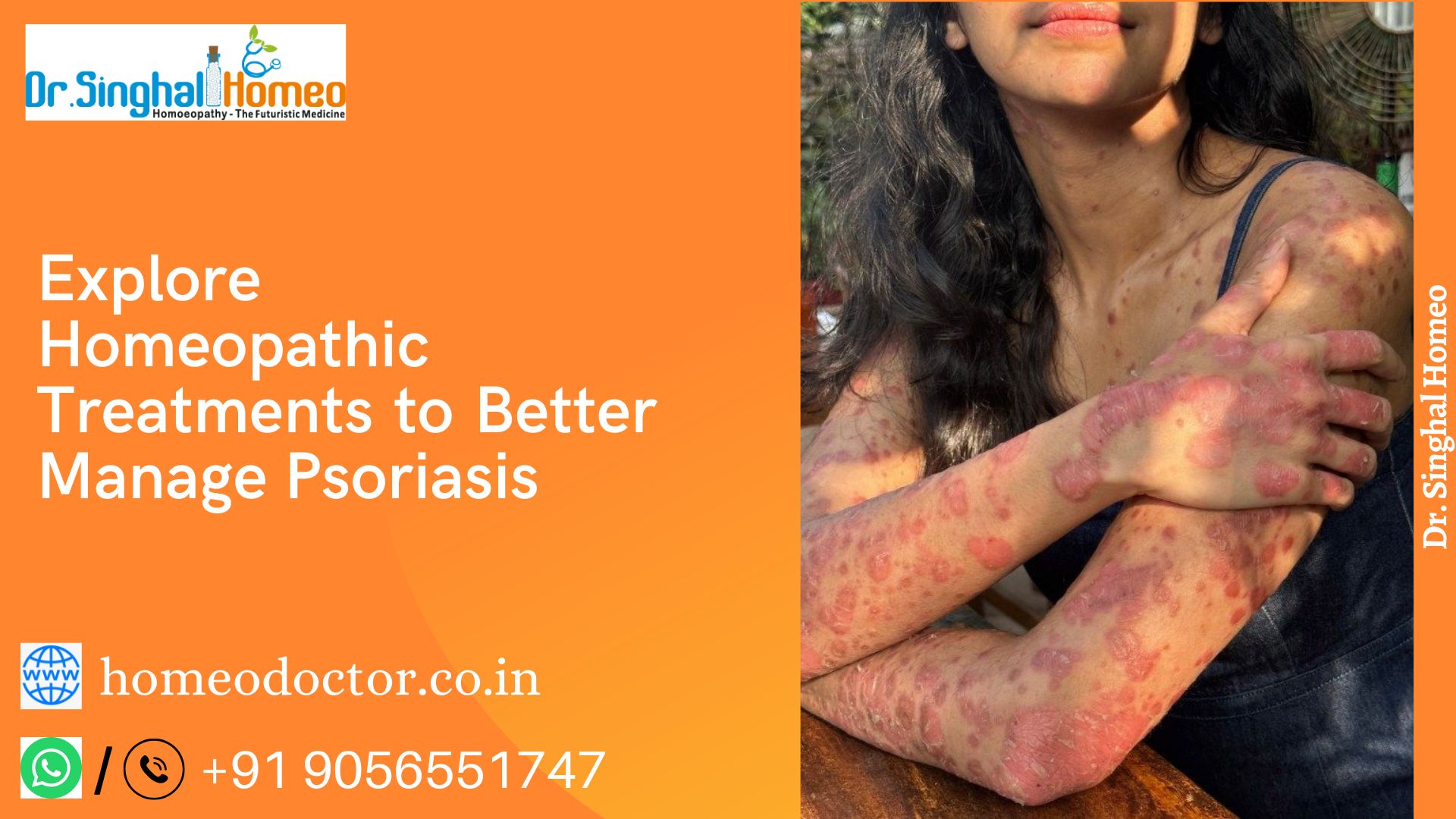Natural Hope: Homeopathic Medicines for Psoriasis Treatment – health
