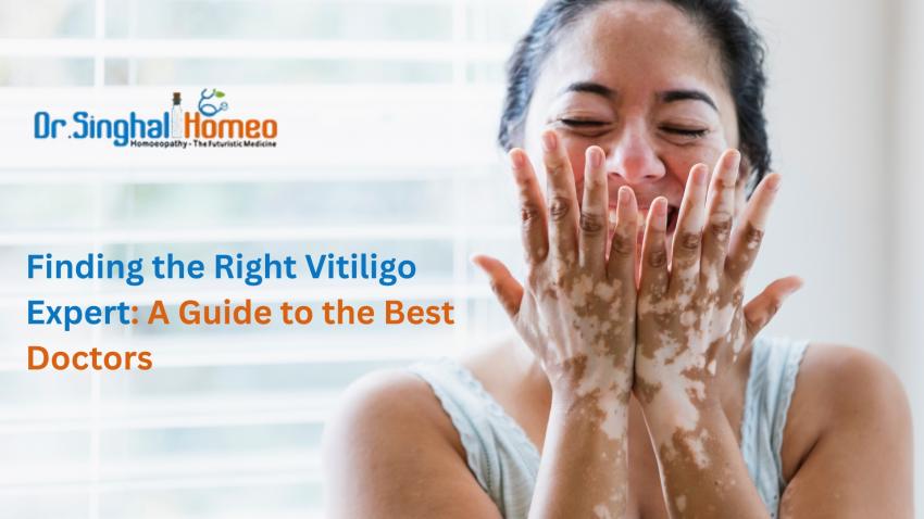 Comprehensive Guide to Homeopathic Vitiligo Treatment: Expert Clinical Care and Therapeutic Approaches | daddycow.com