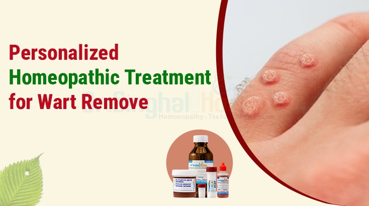 Singhal Homeo: Natural Healing Approaches: Understanding Warts Homeopathy Medicine