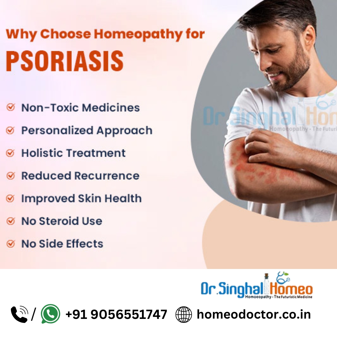 Finding Hope: Your Complete Guide to Psoriasis Treatment in Homeopathy – health