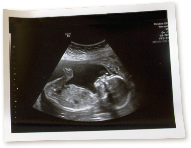 State of the Art Fetal Ultrasounds & Sonograms - Seven Oaks