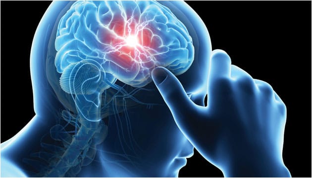Best Homeopathic Treatment for Migraine in India