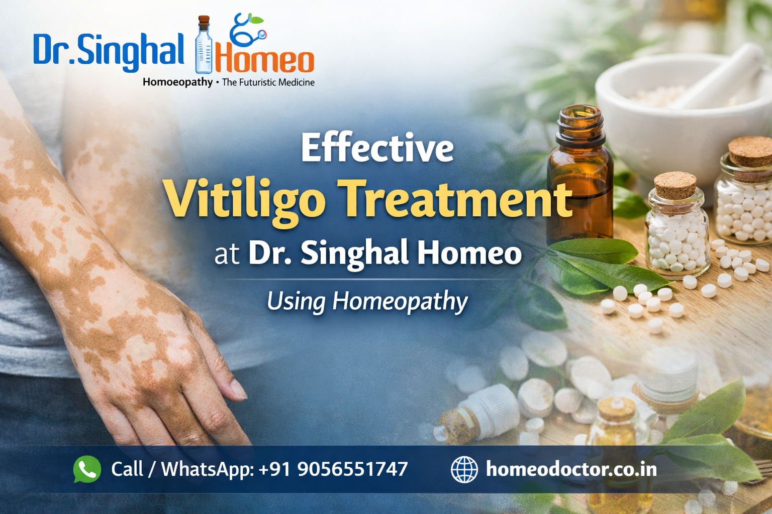 Comprehensive Guide to Vitiligo Treatment: Exploring Homeopathic Approaches with Expert Care – health
