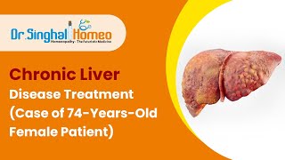 Homeopathic Treatment for Chronic Liver Disease || लिवर (जिगर) की समस्या का होम्योपैथिक उपचार